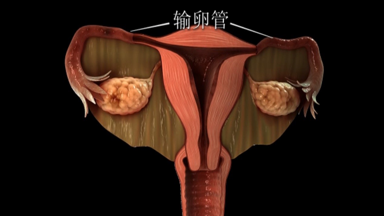 1596767621238683.jpg 1596767621238683.jpg